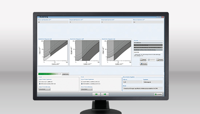 [Translate to Swiss:] EUROIMMUN LSQ Software