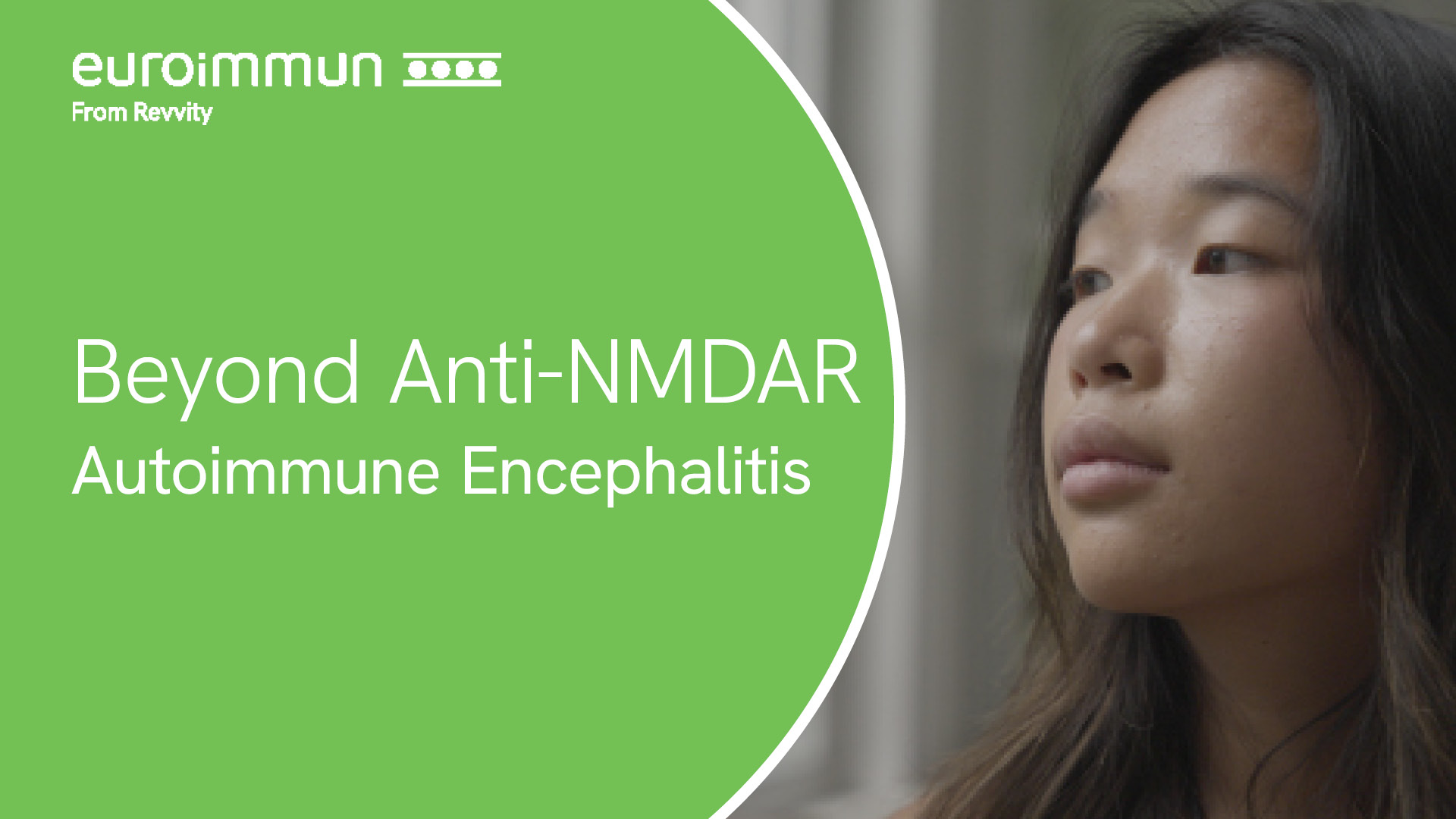 autoimmun encephalitis - video