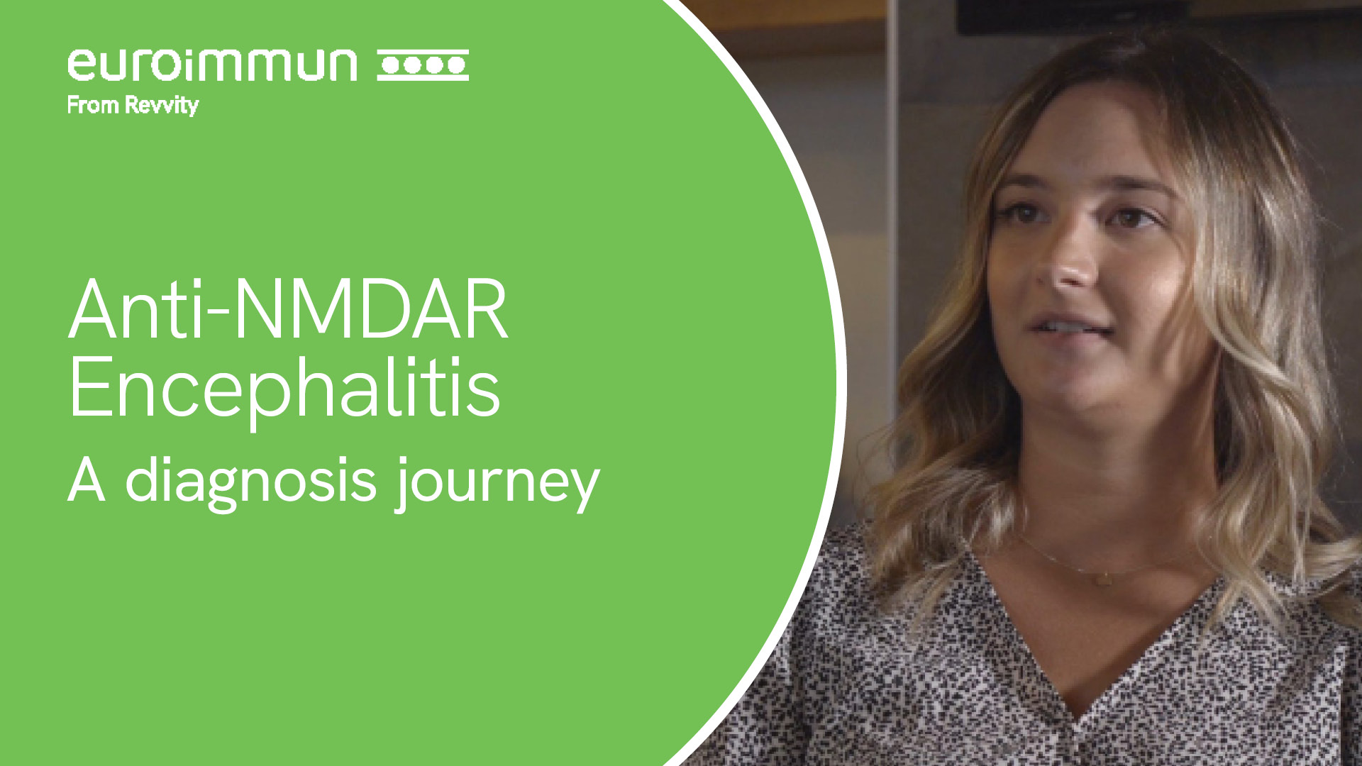 Anti-NMDAR encephalitis - video